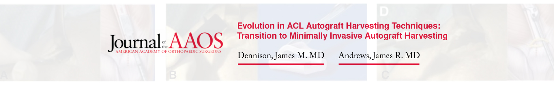 Evolution in ACL Autograft Harvesting Techniques: Transition to Minimally Invasive Autograft Harvesting
